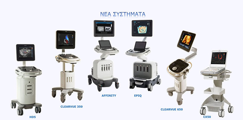 Υπέρηχος