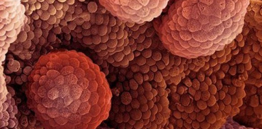 Ογκολογία Ουροποιητικού