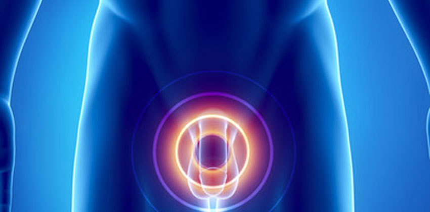 Καρκίνος Προστάτη